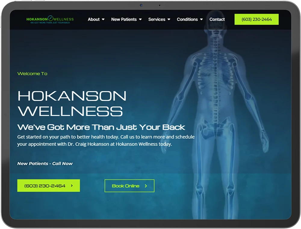 hokanson